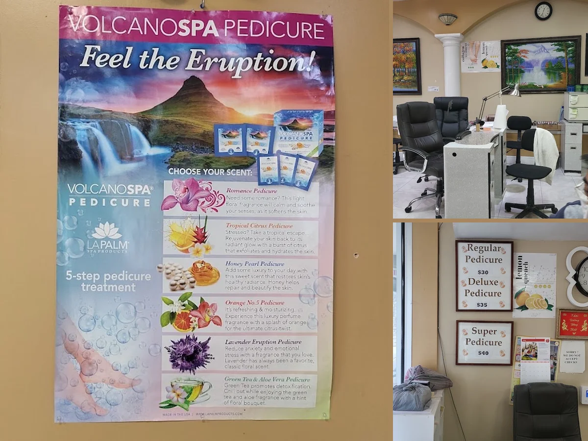 Nail Care in Davenport